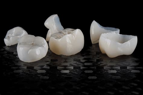 What To Do For A Broken Tooth Crown? Treatment Guide