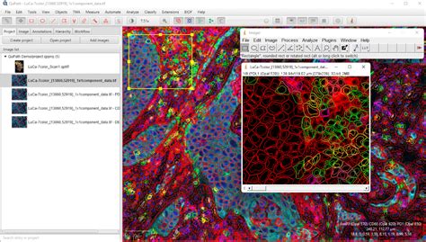 Image result for QuPath Image Analysis
