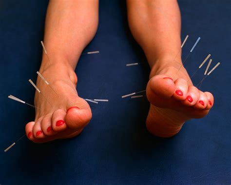 Health alert: Treatment of ankle sprain with acupuncture - India Today