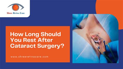 How Long Should You Rest After Cataract Surgery?
