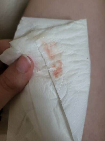 TWW after chemical pregnancy - 6dpo pink spotting? | Mumsnet