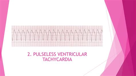 CARDIAC LIFE SUPPORT - EDITED.pptx