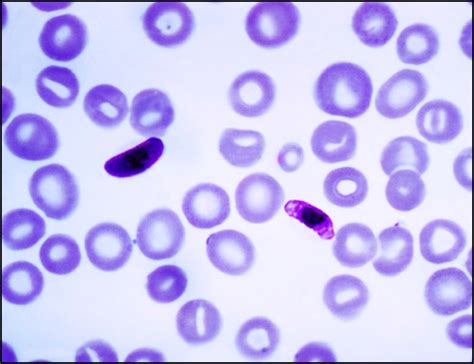 प्लास्मोडियम : जीवनचक्र (Plasmodium : life cycle) – मराठी विश्वकोश