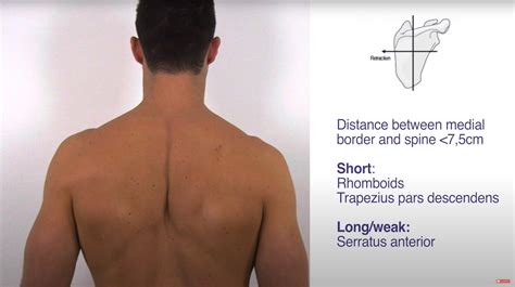 Vertebral Border Of Scapula