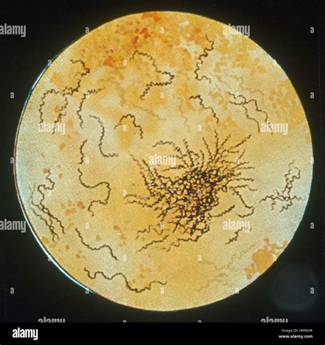 treponema pallidum hemagglutination, treponema pallidum 抗体 – ZSMF