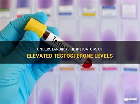 Image result for High Testosterone Levels Sign