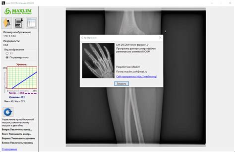 Lim DICOM Viewer - скачать бесплатно Lim DICOM Viewer 1.0