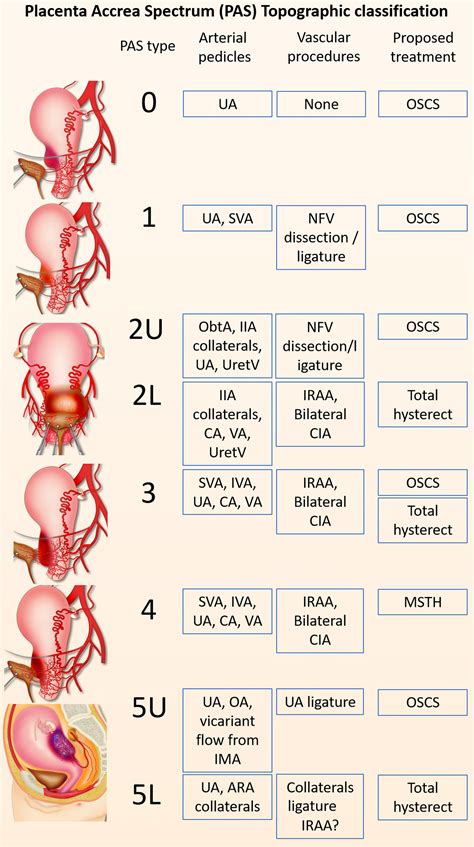 Placenta Accreta Spectrum