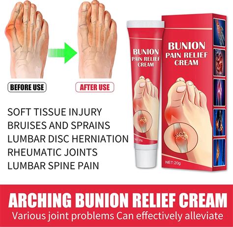 Bunion Pain Relief Cream - Soothing Bunion Relief & Inflammation Treatment 20g | Buy Now with ...
