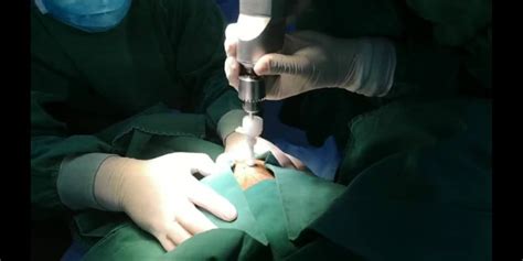 内蒙古中医医院成功完成一例颅内血肿微创穿刺引流手术-内蒙古自治区中医医院