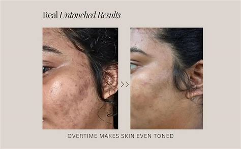 The Formularx Air Brush Facial - All In One Lactic Acid Serum + Glowing ...