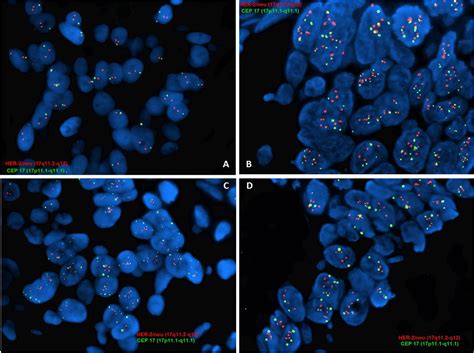 Implementation of the 2018 American Society of Clinical Oncology ...