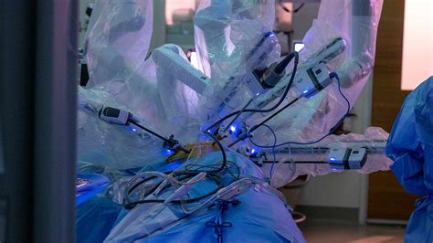 Robotic lung surgery for lung cancer patients | Ohio State Health ...