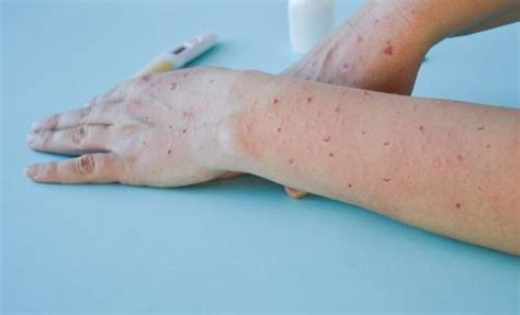 Down To Earth | Latest news, opinion, analysis on environment & science ...