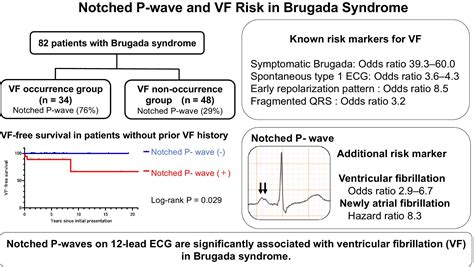 The Utility of Notched P‐Wave on the Occurrence of Ventricular ...