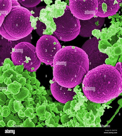 Staphylococcus Aureus Under Microscope 的图像结果