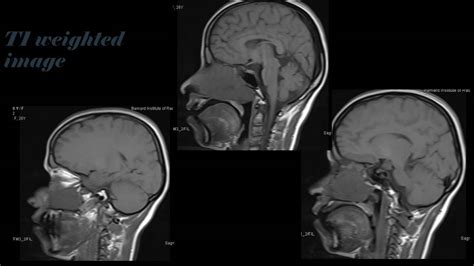 BIR Quiz of the Week