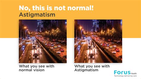 Astigmatism Vision