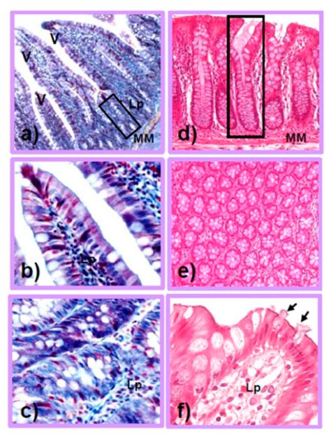 Image result for Intestinal Jejunum