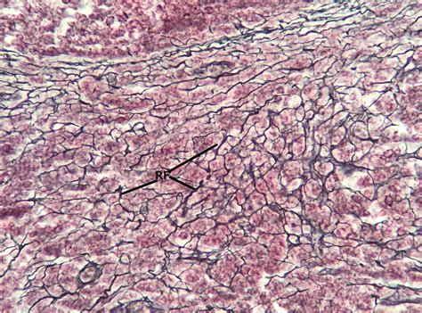 Reticular Connective Tissue - Biology Simple