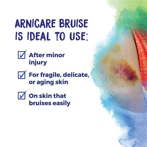 Buy Boiron Arnicare Bruise Cream for Pain Relief from Bruising and ...