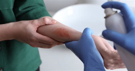 Pain Relief Gels vs. Sprays: Which is Fast & More Effective?