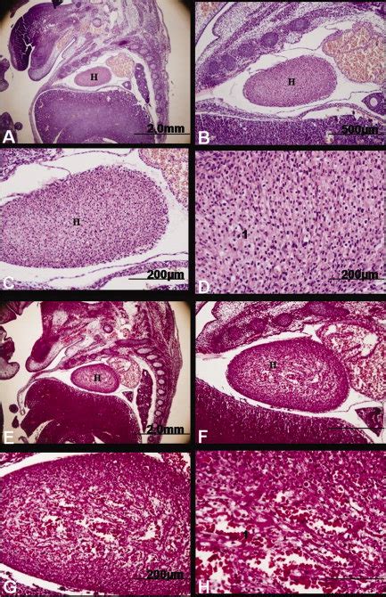 Image result for Mouse Embryo Heart Development