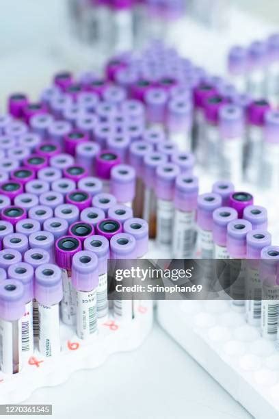 323 Specimen Collection Tubes Stock Photos, High-Res Pictures, and Images - Getty Images