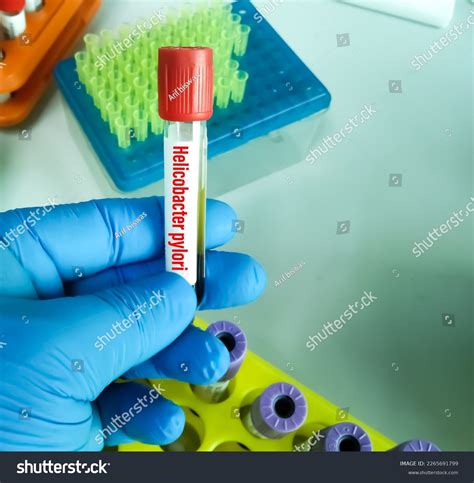 13 H Pylori Breath Test Images, Stock Photos & Vectors | Shutterstock