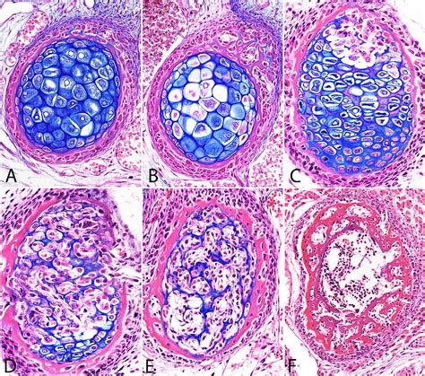 Bone Development Algorithm 的图像结果