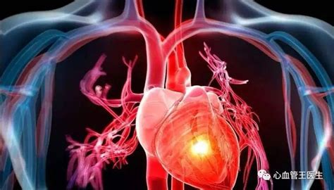 心脏病发作前有哪些前兆和信号？心脏病专家告诉您答案！|心脏病|心血管|冠心病|症状|心衰|-健康界