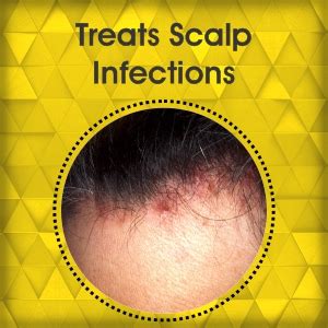 UrbanGabru Apple Cider Vinegar Hair Mask for hair growth & hairfall ...