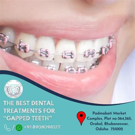 Dazzle Dental Care - Top Dentists & Dental Clinics in Old Town Bhubaneswar