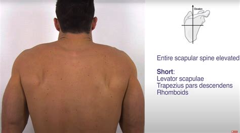 Scapular Spine