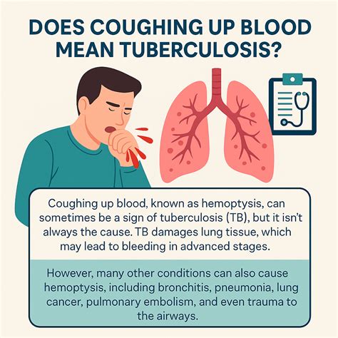 Does Coughing Up Blood Mean Tuberculosis? (2026)