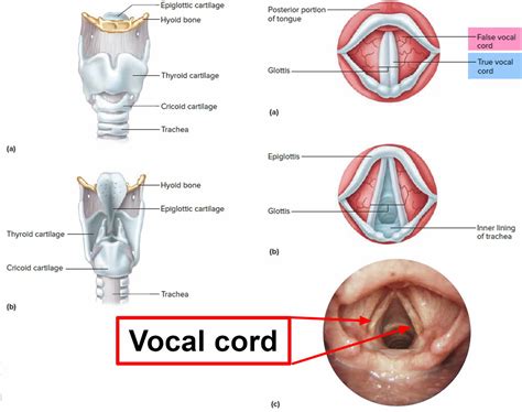 Vocal cord cyst causes, symptoms, diagnosis, treatment & prognosis