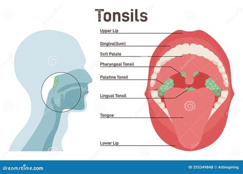 Tonsils Diagram