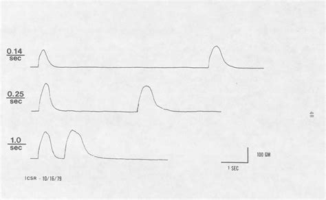 Image result for Crossed Extensor Reflex