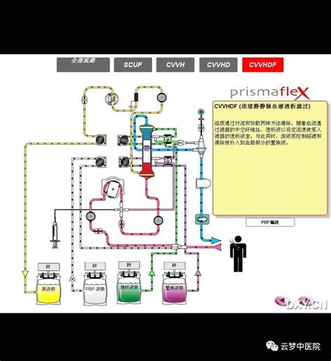 CRRT Recirculation 的图像结果