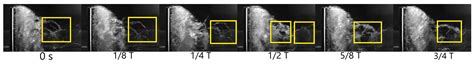 Experimental Study of the Cavitation Effects on Hydrodynamic Behavior ...