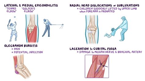 Video: Anatomy clinical correlates: Arm, elbow and forearm | Osmosis