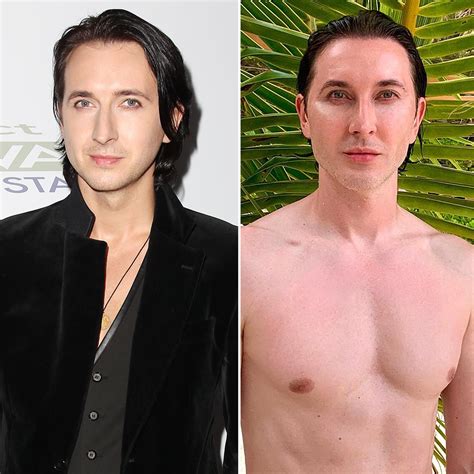 Dmitry Sholokhov Face Surgery