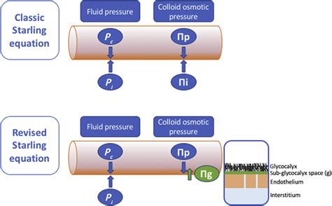 Choice of fluid type: physiological concepts and perioperative ...