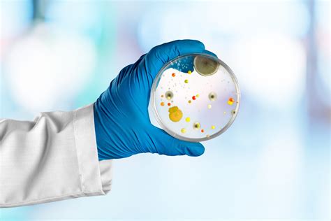 Image result for Mold Testing Flare