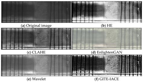Research on the Contrast Enhancement Algorithm for X-ray Images of ...