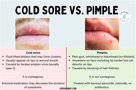 Image result for Pimple From Dry Lips