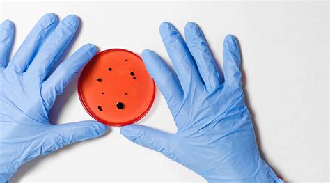 Coliform Bacteria in Water - Effects, Presence, Testing and ...