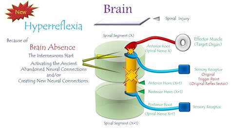 Hyperactive Reflexes 的图像结果