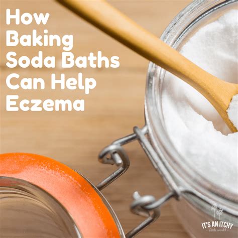 Why Baking Soda Baths for Eczema Can Work!