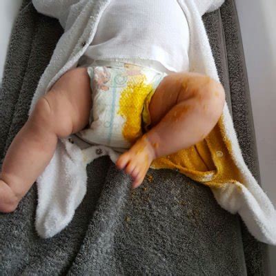 Baby Poop Explodes 的图像结果